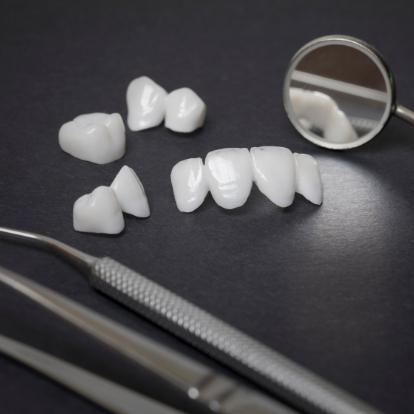 Several white dental crowns and veneers on table with dental mirror