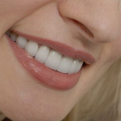 Close up of person smiling with flawless white teeth