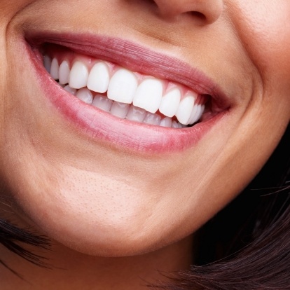 Close up of person smiling with straight white teeth