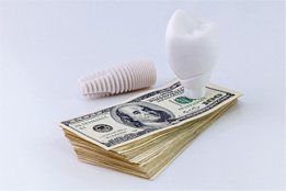 Dental implant separated into parts
