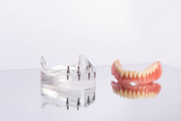 Model of removable implant denture on table