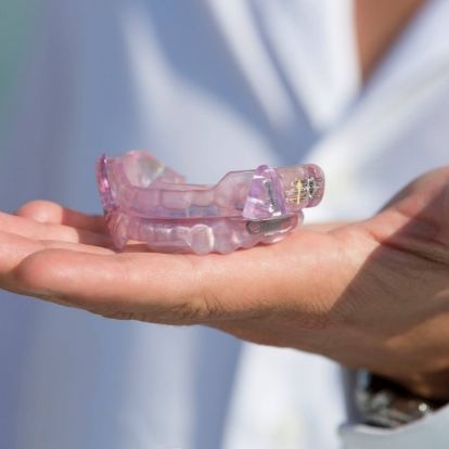 Hand holding light purple occlusal splint trays